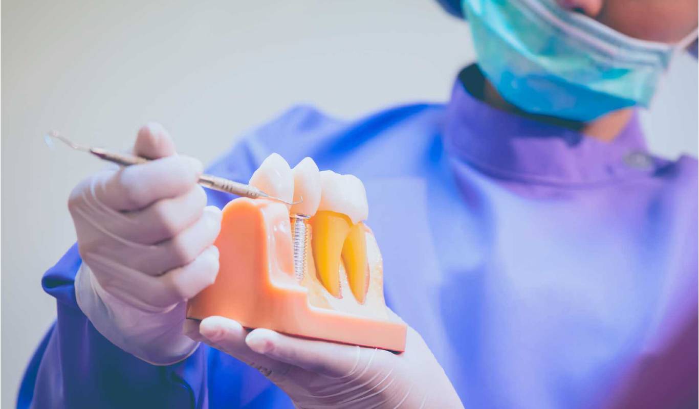 What is Dental Implant? | Types, Medical Procedures and Precautions