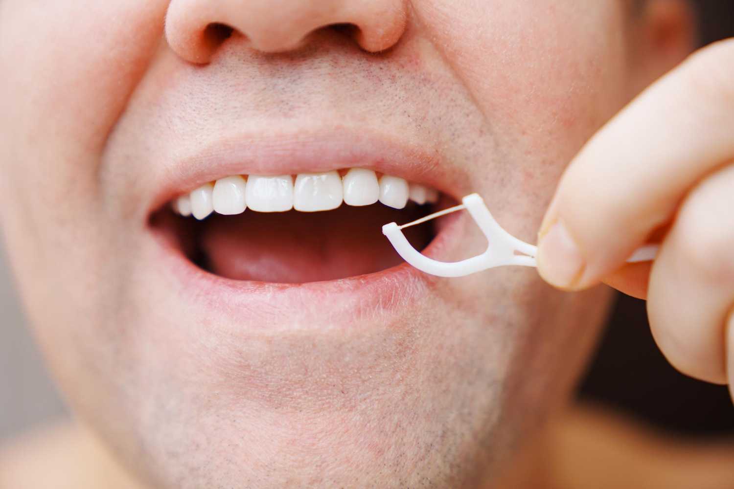 Benefits of Flossing